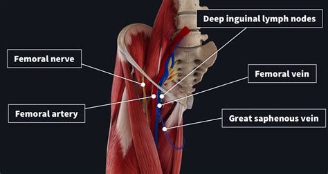 what is femoral.